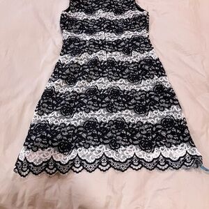 Chic Black and White Lace Midi Dress